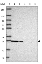 Anti-EFNA5 Antibody