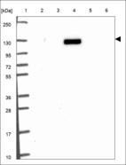 Anti-ABTB3 Antibody