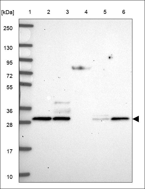 Anti-RAD51D Antibody