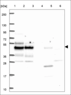 Anti-CWC25 Antibody