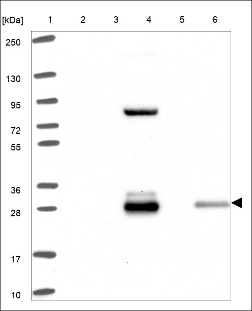 Anti-SOST Antibody