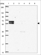 Anti-GRB7 Antibody