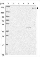 Anti-LTBP4 Antibody