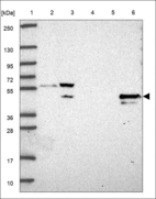 Anti-RBBP7 Antibody