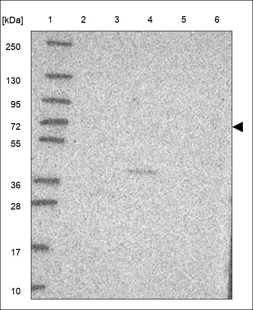 Anti-MMP10 Antibody