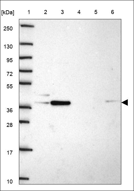 Anti-TMEM41B Antibody