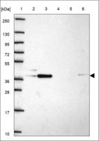 Anti-TMEM41B Antibody