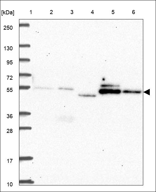 Anti-SOCS6 Antibody