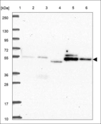 Anti-SOCS6 Antibody