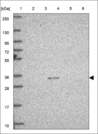 Anti-FOXR1 Antibody