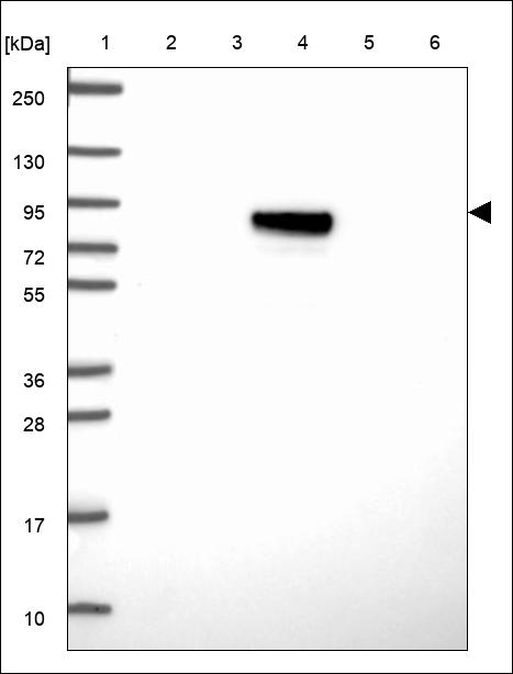 Anti-ANKRD6 Antibody