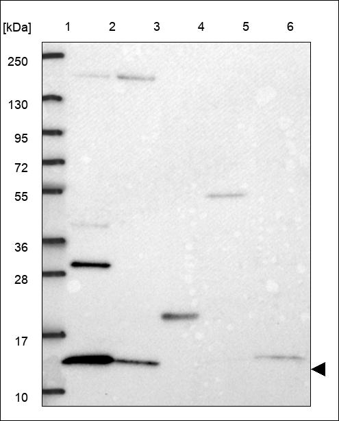 Anti-UQCRQ Antibody