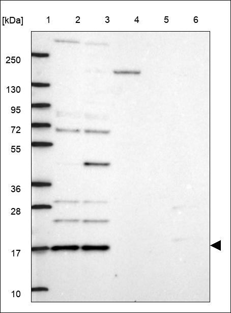 Anti-GEMIN7 Antibody