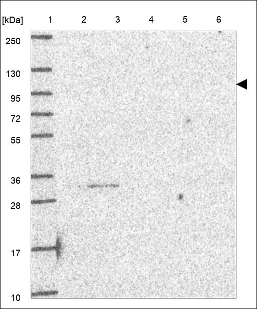 Anti-ADAMTS4 Antibody