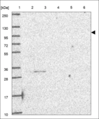 Anti-ADAMTS4 Antibody