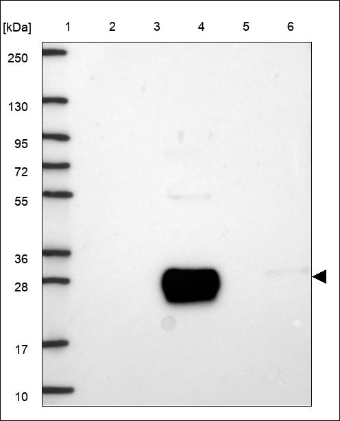 Anti-DKK2 Antibody