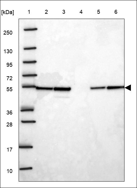 Anti-ENO1 Antibody