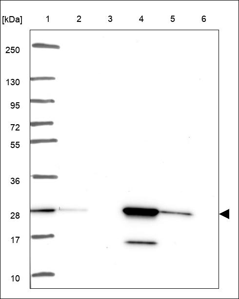 Anti-NUS1 Antibody