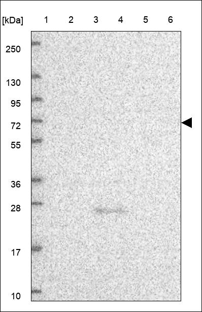 Anti-BIVM Antibody