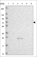 Anti-BIVM Antibody
