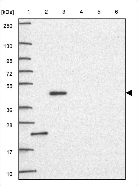 Anti-TBP Antibody