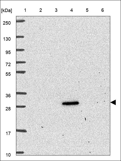 Anti-RASL11B Antibody