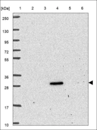 Anti-RASL11B Antibody