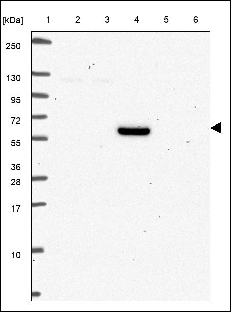 Anti-TMEM161A Antibody