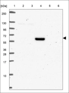 Anti-TMEM161A Antibody
