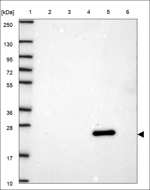 Anti-HHEX Antibody