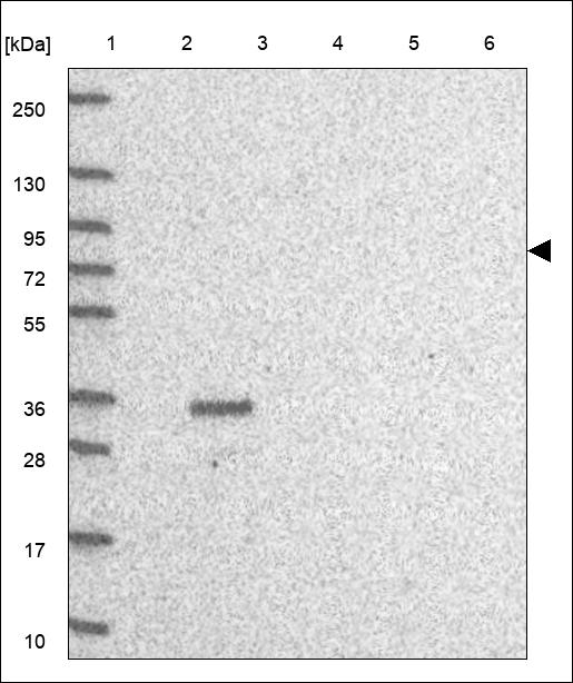 Anti-PIAS2 Antibody