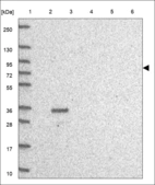 Anti-PIAS2 Antibody