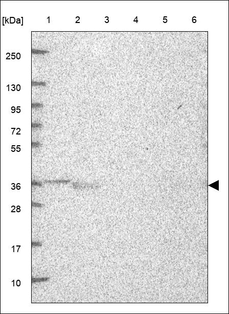 Anti-GPD1L Antibody