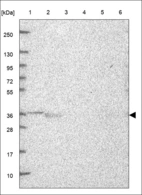 Anti-GPD1L Antibody