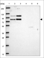 Anti-RLIM Antibody