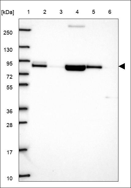 Anti-ACSS2 Antibody