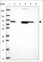 Anti-ACSS2 Antibody
