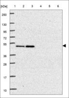 Anti-NUDT19 Antibody