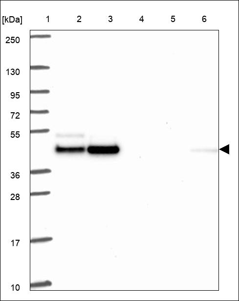 Anti-VDR Antibody