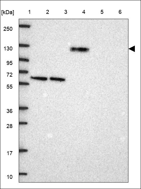 Anti-UMODL1 Antibody