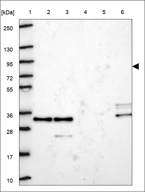 Anti-KLHL22 Antibody