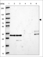 Anti-KLHL22 Antibody