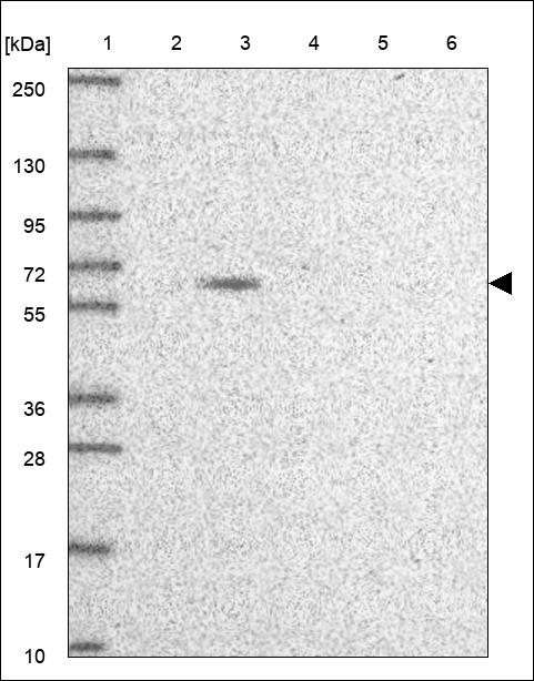Anti-PPP2R2D Antibody
