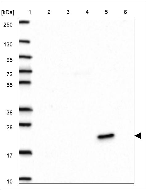 Anti-FCN3 Antibody