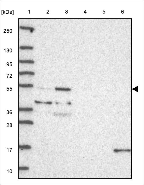 Anti-B4GALT5 Antibody