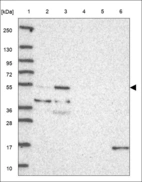 Anti-B4GALT5 Antibody