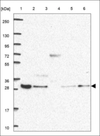 Anti-RTF2 Antibody