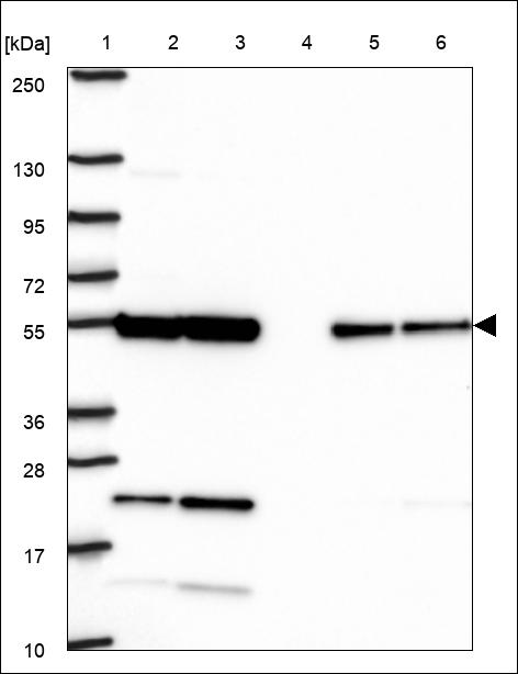 Anti-SEPTIN11 Antibody