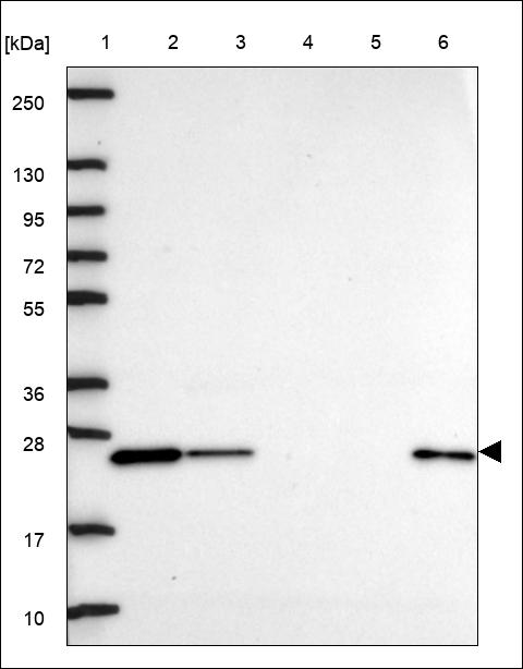 Anti-PRDX2 Antibody