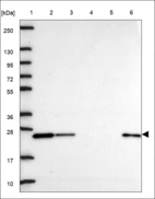 Anti-PRDX2 Antibody